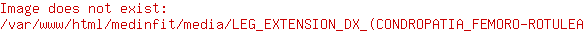 Leg extension destro (condropatia femoro-rotulea)